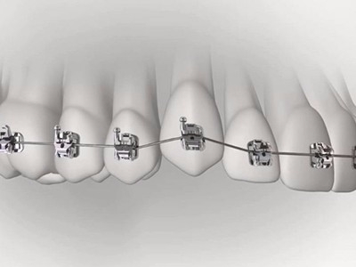 承德市哪家口腔醫(yī)院口腔正畸做得好？惟德口腔醫(yī)院來告訴您