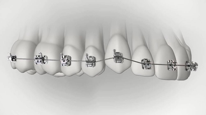 承德市哪家口腔醫(yī)院口腔正畸做得好？惟德口腔醫(yī)院來告訴您